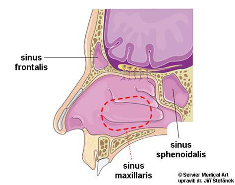 Schéma anatomie vedlejších nosních dutin