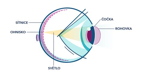 korekce astigmatismu v oku (vizuální ilustrace válcovitého cylindru)