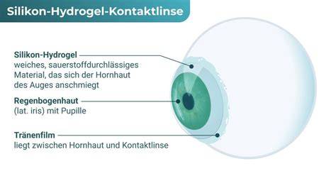 infografika rozdíl hydrogel silikon-hydrogel