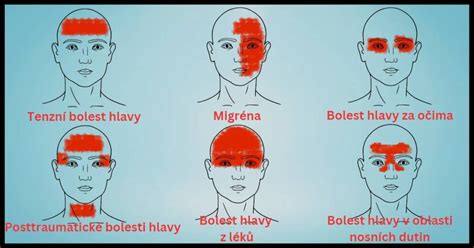 Infografika: bolesti očí a související bolesti hlavy