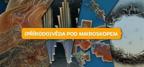 kryogenicky zmrazené vzorky elektronového mikroskopu
