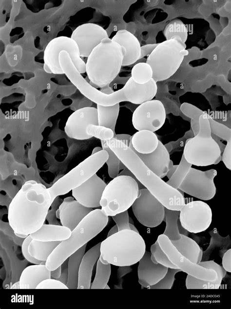 Candida albicans SEM vzorek